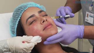 Prp face Treatment - Omnicare Medical And Aesthetic بلازما للوجه - أمنيكير للطب والتجميل
