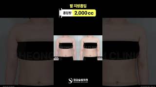 팔 라인 때문에 스트레스라면 ✨