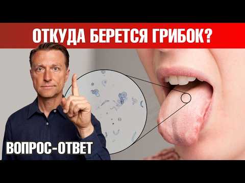Кандида? Грибок ногтя на ноге или на коже головы 👉 реальные причины Кандида? Грибок ногтя на ноге или на коже головы 👉 реальные причины