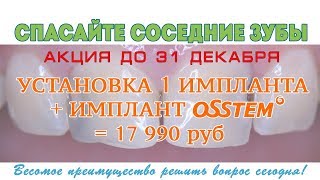 Корейские импланты зубов Osstem рейтинг и отзывы врачей и пациентов