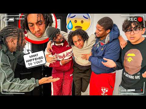 He Got Beat Up - Prank Gone Wrong