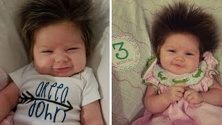 Adorable 3-Month-Old Girl With Full Head of Hair Is Making Heads Turn