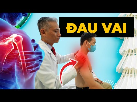 Đau Vai Sau Khi Chơi Cầu Lông? Khám Phá Cách Chữa Trị Hiệu Quả Nhất!
