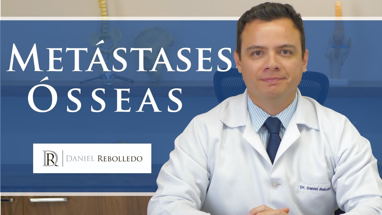 Metástase óssea. Diagnóstico inicial/  Metástase óssea Tratamento /2020)