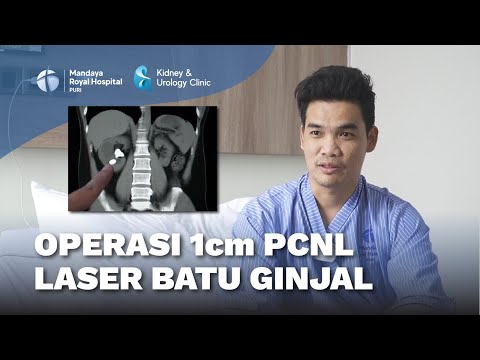 Operasi Batu Ginjal dengan Laser PCNL, Hancurkan Batu Ukuran 2 cm - dr. Maruto Harjanggi, Sp.U