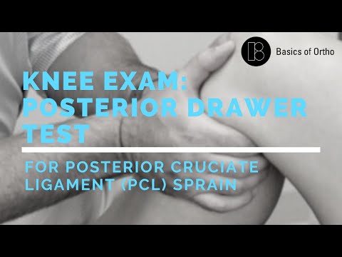 Knee Exam:  The Posterior Drawer Test for Posterior Cruciate Ligament (PCL) Sprain/Tear