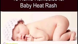 15 Must Know Home Remedies for Baby Heat Rash
