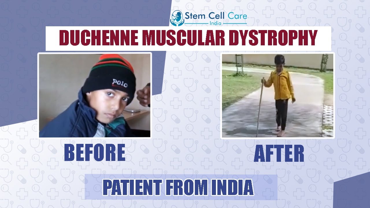 The patient's father share his experience after stem cell treatment for Duchenne Muscular Dystrophy