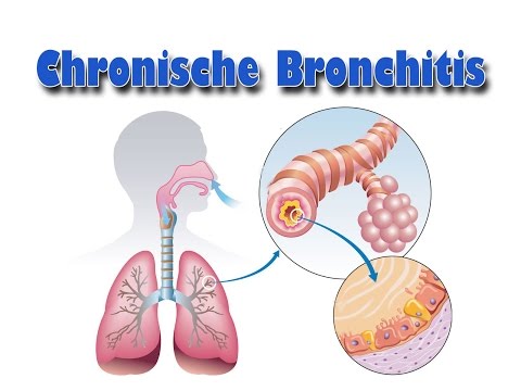 Antibiotika bei der Behandlung von akuten Prostatitis Jucken in der Leiste bei Männern Prostatitis