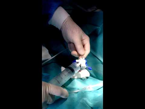 Sindrome di mal di collo Clinica specializzata in sostituzione delle articolazioni