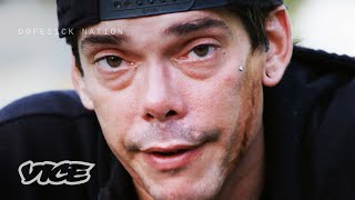 How Scars Show the Struggles of Addiction