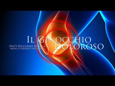 Sindrome radicolare nella colonna cervicale Artrosi terzo grado di spalla