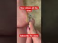 #feet #footcallusremoval #callusremoval #asmr #foot #callus #goddess #peeling