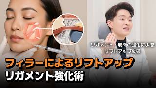 フィラー(ヒアルロン酸)を用いた｜支持靭帯リフト🌠｜