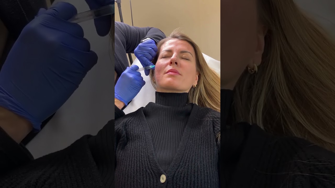 Cóctel de vitaminas inyectadas