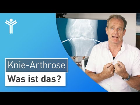 Knie-Arthrose: Was ist die Arthrose des Kniegelenks und wie kommt es zum Gelenkverschleiß?