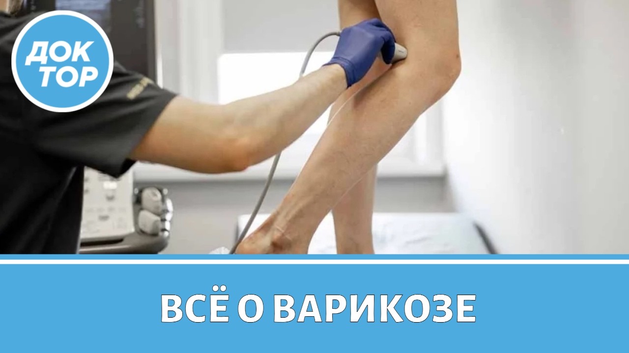 Варикоз не помеха: готовим ноги к теплому сезону