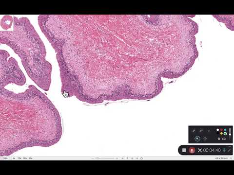 BIOL 314 Lab Exercise 40 Ureter, Urinary Bladder, and Urethra Anatomy and Histology