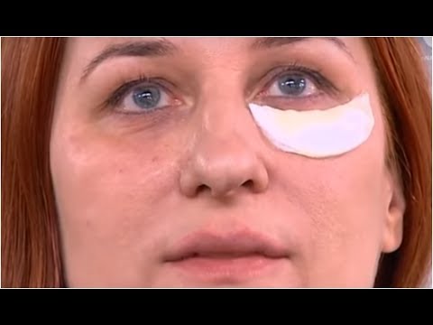 Jak używać oleju łopianu na wypadanie włosów Cielęta choroby łysienie