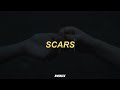 Lukas Graham Scars Lyrics Sub Espa