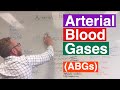 Arterial Blood Gases ABGs Interpretation