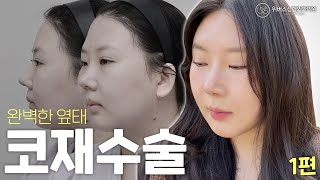 완벽한 옆태 코재수술 [1탄]