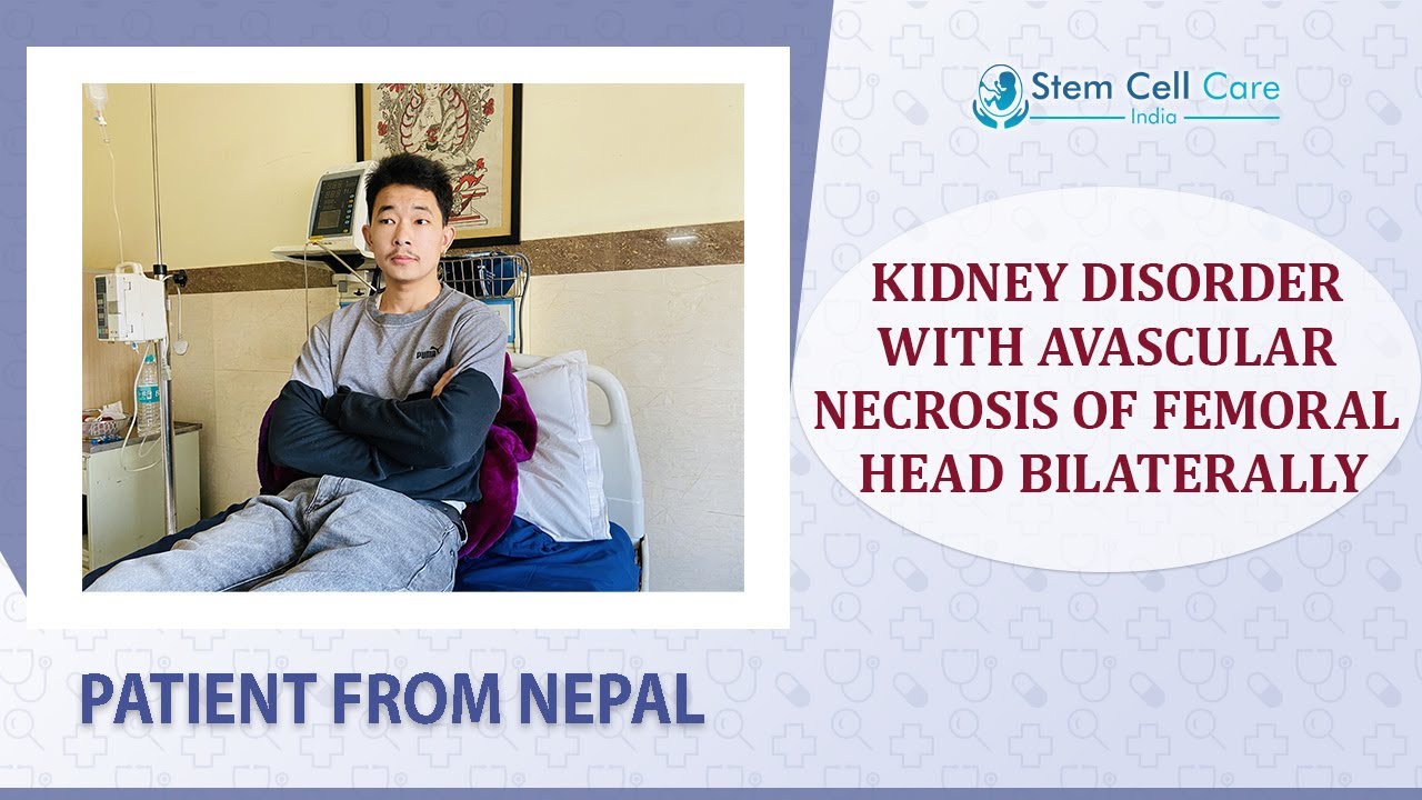 Patient with Avascular Necrosis of Femoral Head bilaterally shares his experience at SCCI