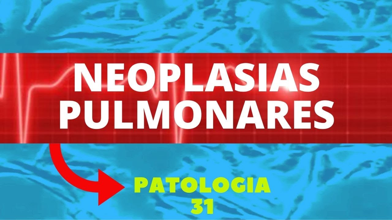 NEOPLASIAS PULMONARES - PATOLOGIA 31