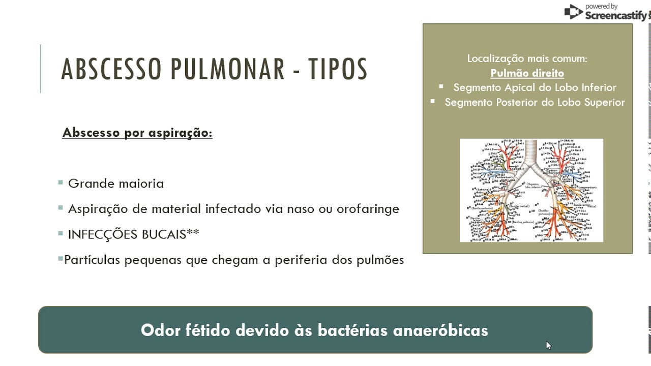 Abcesso pulmonar