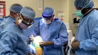 Unicompartmental Knee Replacement Explained by Dr. David Taunton