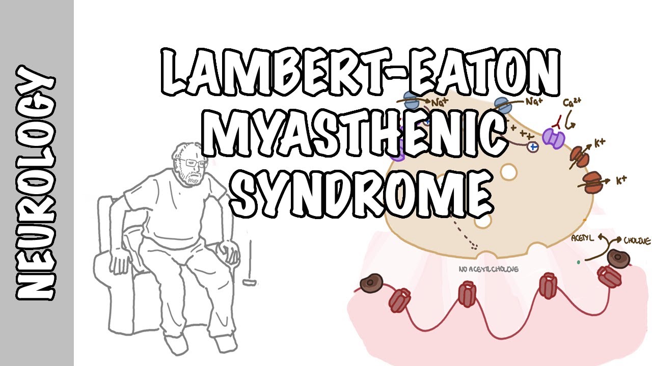 Lambert-Eaton Myasthenic Syndrome - pathophysiology, signs and symptoms and treatment