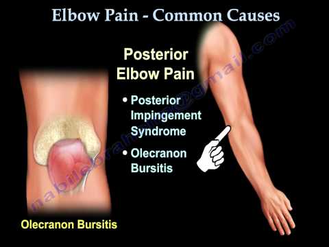 ELBOW PAIN , COMMON CAUSES - Everything You Need To Know - Dr. Nabil Ebraheim