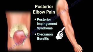 ELBOW PAIN , COMMON CAUSES - Everything You Need To Know - Dr. Nabil Ebraheim