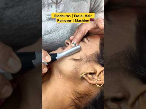Facial Hair - Sideburns Remover Machine #sideburns #skincare  #facialhairremoval