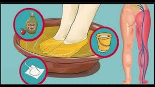 Dites au revoir à la douleur du nerf sciatique avec cette méthode naturelle