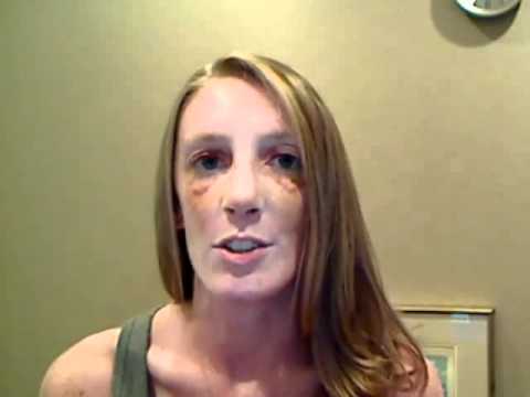 Patient Testimonial for Rhinoplasty (Nose Job)