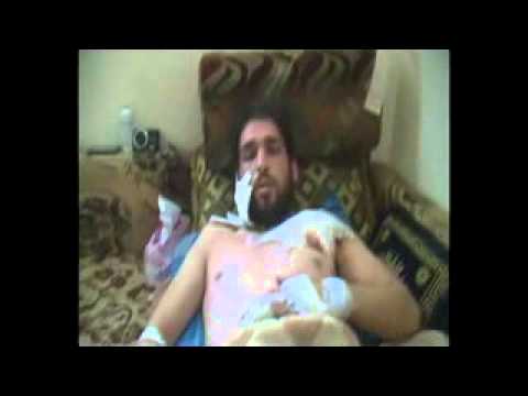 إصابة قائد كتيبة درع الاسلام التابع لقوات المغاوير في حمص