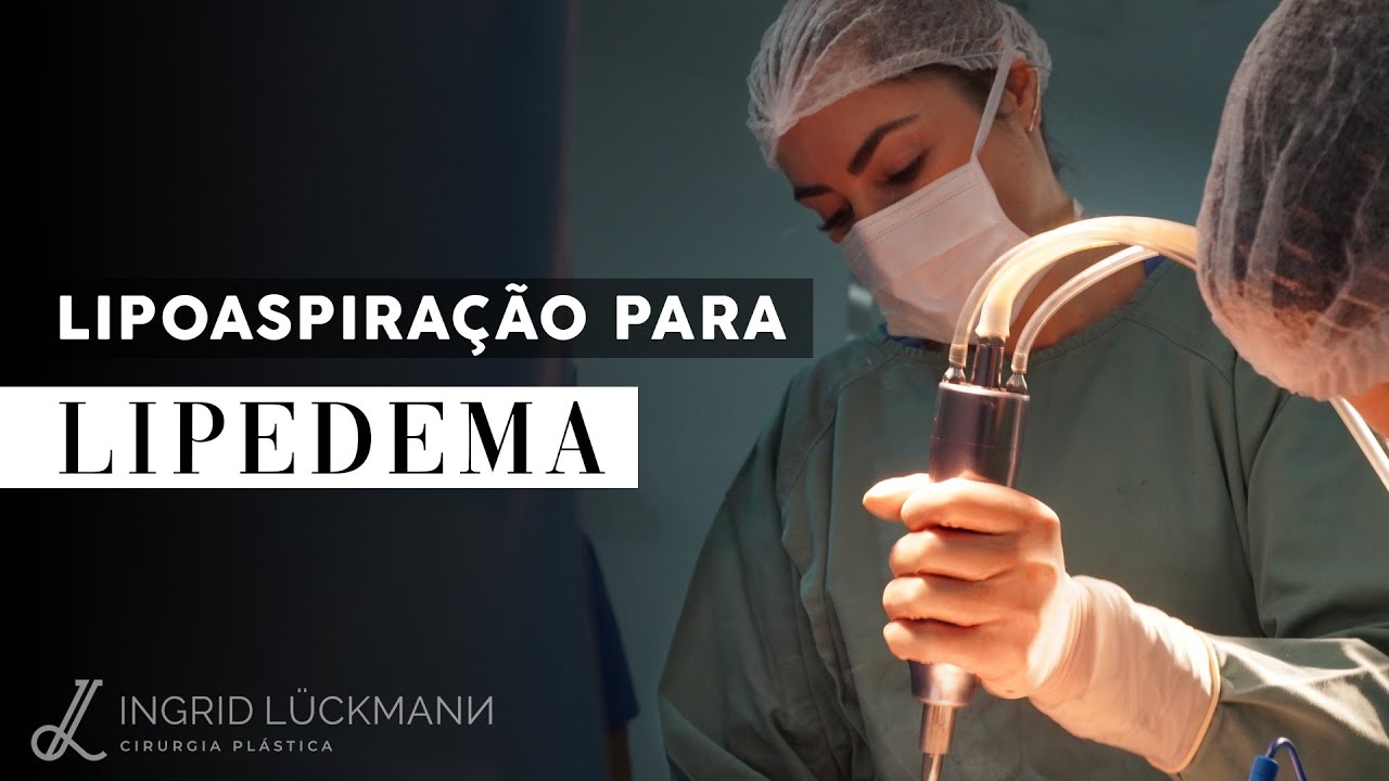 Lipoaspiração para Lipedema: Tratamento Cirúrgico Explicado