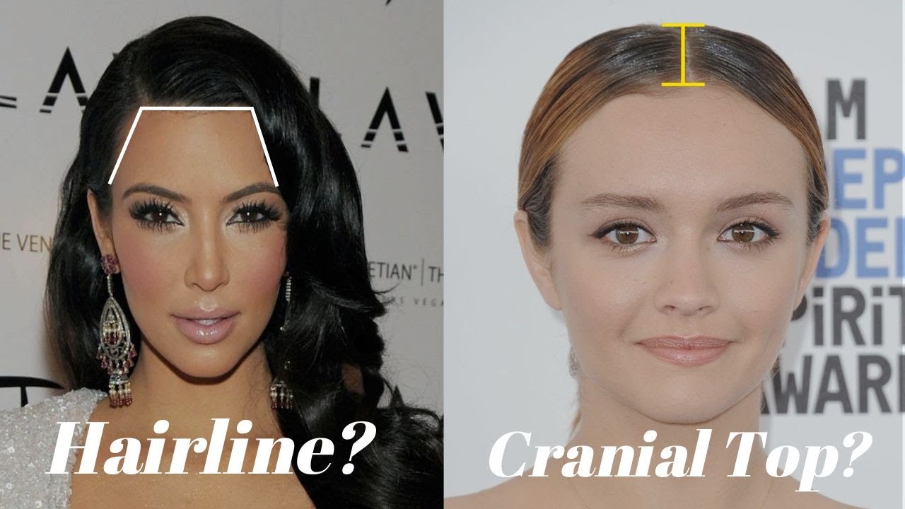How does Hairline & Cranial Top affect Hairstyles?