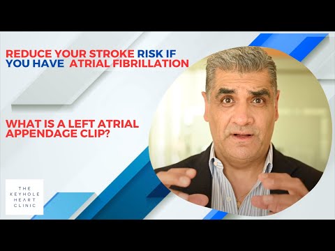 Reduce Your Stroke Risk If You Have Atrial Fibrillation