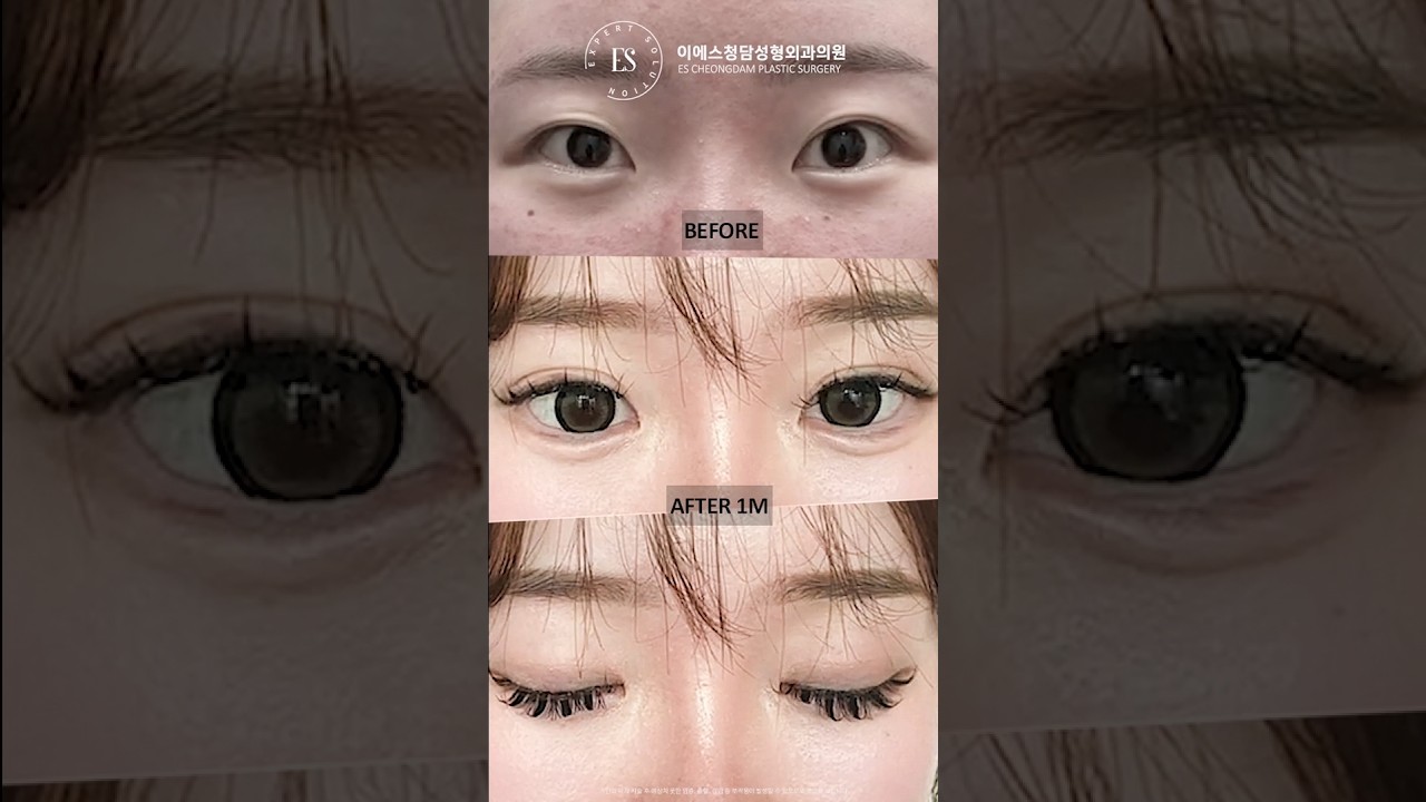 이에스 유튜브
