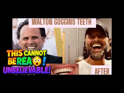 Walton Goggins' Smile Under Scrutiny Did 'White Lotus' Feud Fuel SNL 'Like'