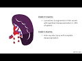 Splenic Injury