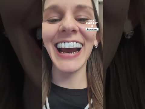 Getting Diamond Grillz After Losing My Teeth 🦷💛 #grillz #veneers #teeth @denturedame