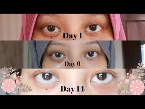 download lagu mp3 mp4 Yves Rocher Serum Vegetal Review, download lagu Yves Rocher Serum Vegetal Review gratis, unduh video klip Yves Rocher Serum Vegetal Review