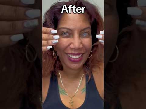 ColorEyes is quick and easy with immediate results.