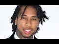 Tyga Reacts To Nicki Minaj Exposing His Fake Hairline | Hollywoodlife Tyga Reacts To Nicki Minaj Exposing His Fake Hairline | Hollywoodlife