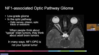 Akron Children's Neurofibromatosis Conference 2024: Part 1