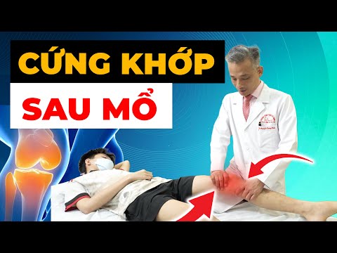 KHỦNG HOẢNG Sau Phẫu Thuật ACL: Khớp Gối Cứng Như Gỗ - Có Phải Do Tôi?