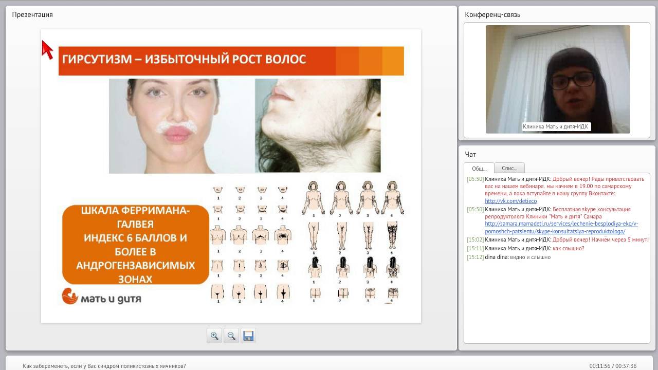 Превью видео на тему ЭКО при поликстозе яичников